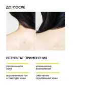 Обновляющий крем для тела с кислотами Skin Renewal ICON SKIN, 200 мл фото 5