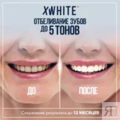 Крем-гель для отбеливания зубов XLASH Teeth Whitening Cream Gel фото 2