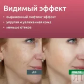 Контактный гель для микротоков Readyskin Care Lifting Gel 250 мл фото 5