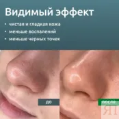 Контактный гель для ультразвуковой чистки лица Readyskin Care 250 мл фото 5