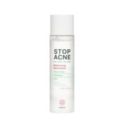 Балансирующий тонер для лица Hiskin Stop Acne AHA + BHA + Tea tree 150мл 3144827 фото 4